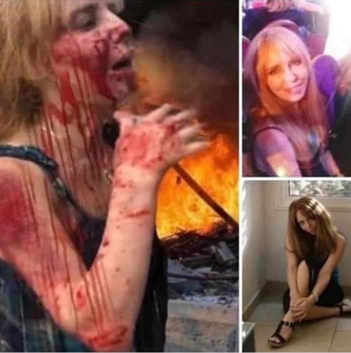 إصابة ابتسام غنيم (1)