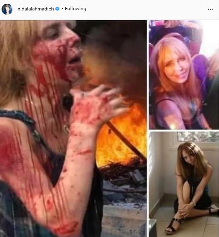 إصابة ابتسام غنيم (2)