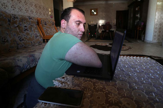 أبو عميرة يستخدم جهاز كمبيوتر محمول في منزله بغزة