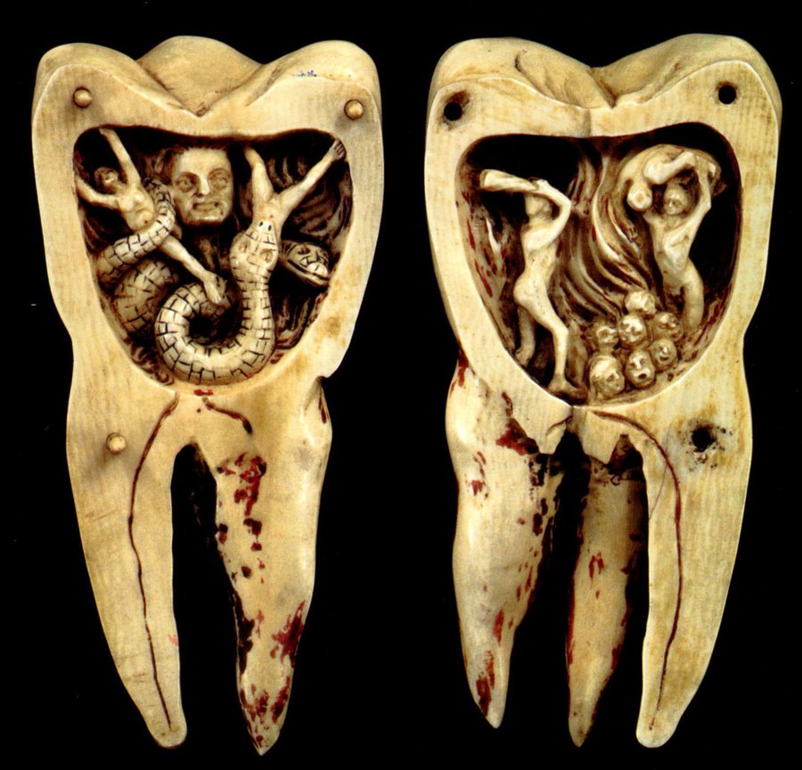 ديدان الأسنان
