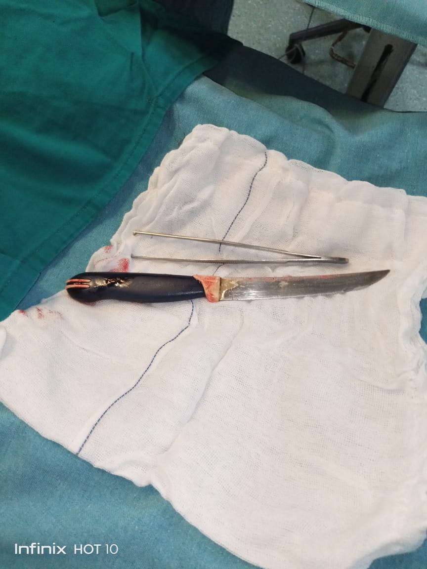 السكين المستخرج من معدة المريض