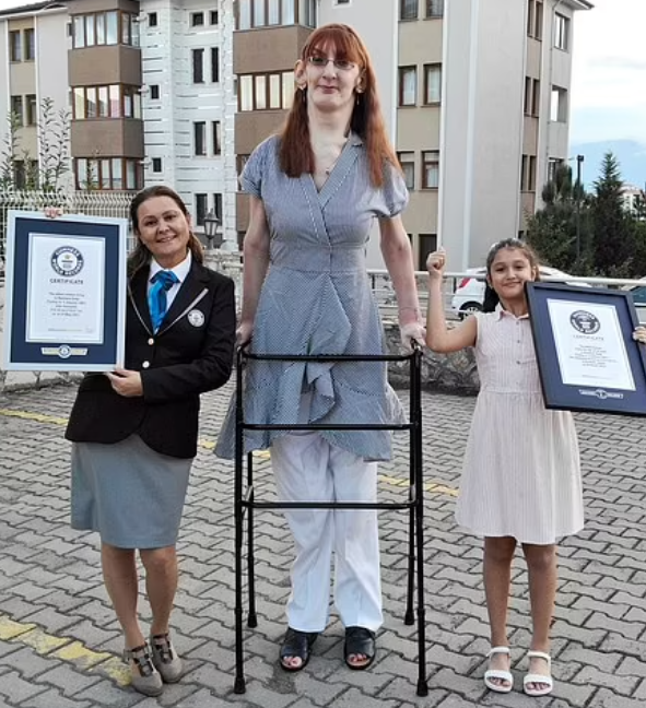 جيلجي  اطول امرأة فى العالم