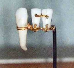 Ancient_Egypt_Dentistry4-300x273