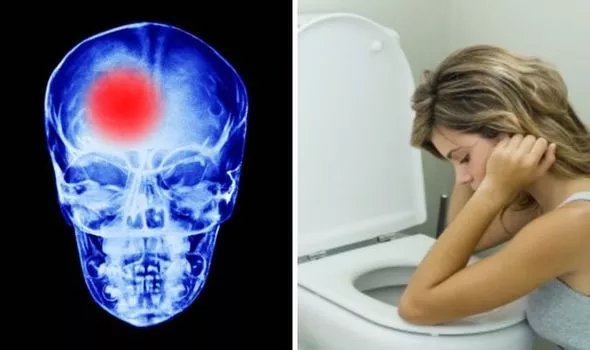 اعراض السكتة الدماغية لدى النساء