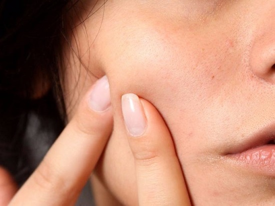 Recipes to get rid of facial scars