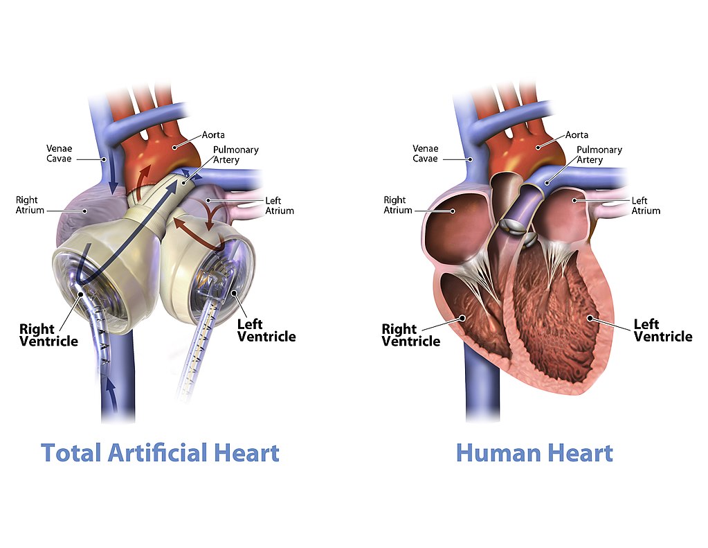 مقارنة بين القلب الصناعي و الطبيعي