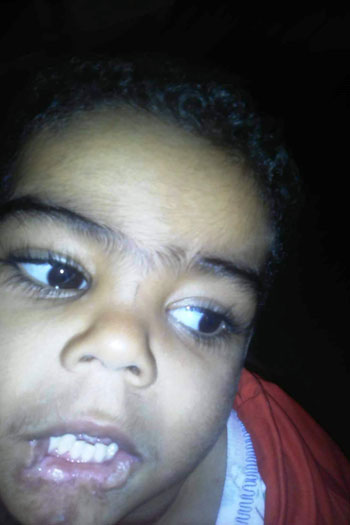 طفل مصاب بمرض نادر فى كفر الشيخ (3)