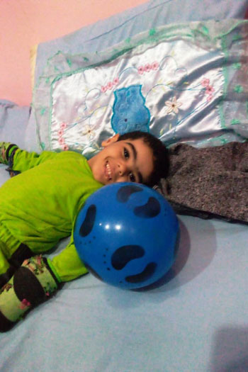 طفل مصاب بمرض نادر فى كفر الشيخ (2)