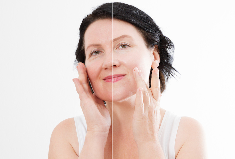 menopause-skin-affects