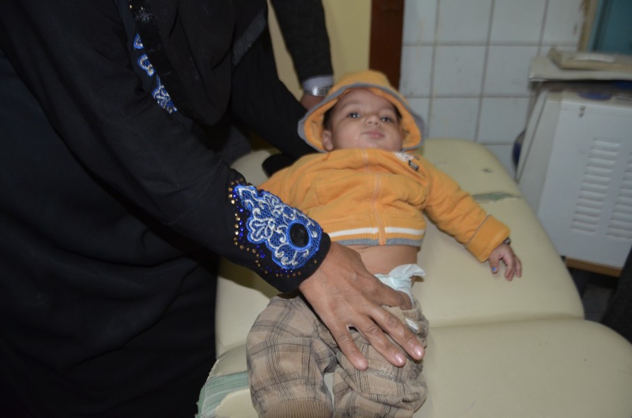 حملة التطعيم ضد شلل الاطفال بالاقصر