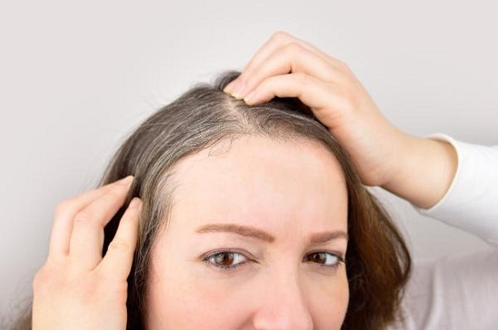 وصفات طبيعية لمقاومة الشعر الأبيض (4)
