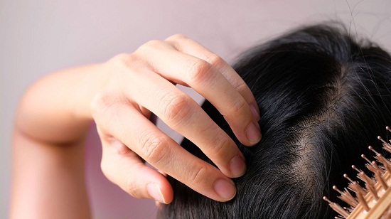 وصفات الطبيعية لعلاج تساقط الشعر