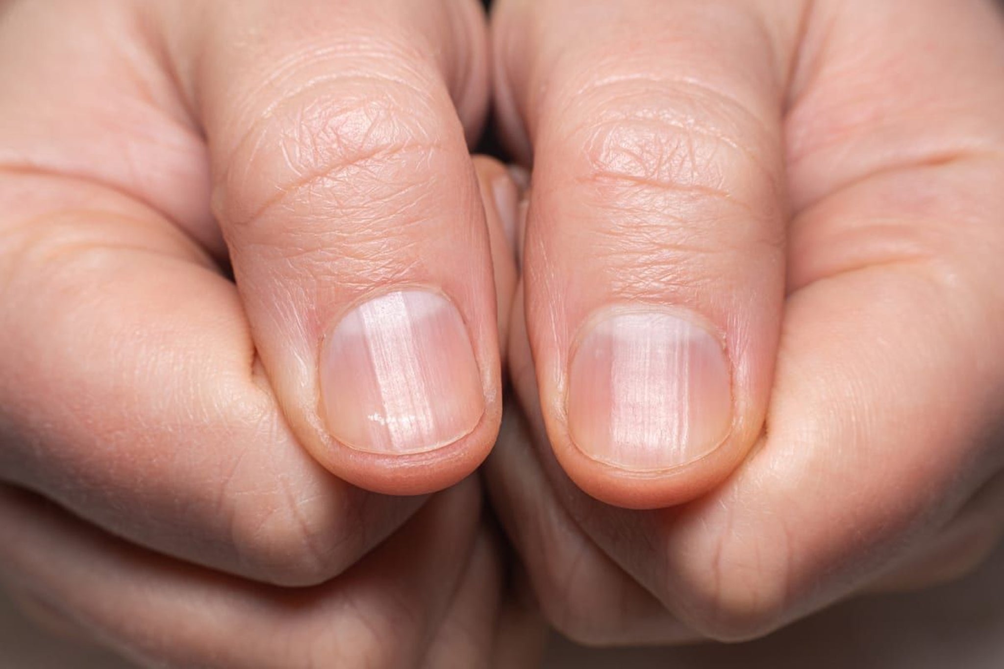 how-to-get-rid-of-ridges-on-nails