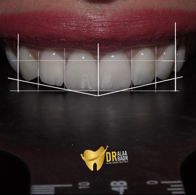 مركز الدكتورة آلاء بدر الأسنان  (3)