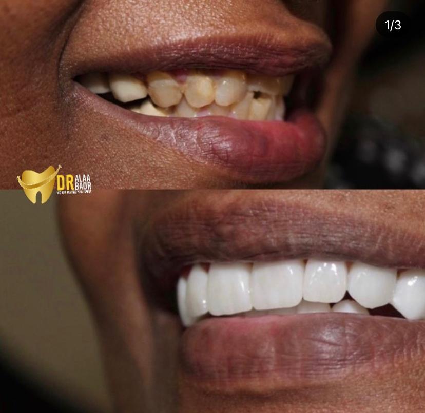 مركز الدكتورة آلاء بدر الأسنان  (2)