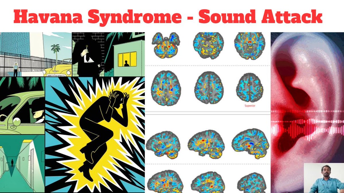 متلازمة هافانا