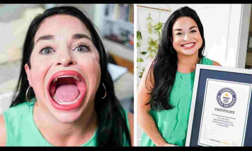 صاحبة اكبر فم في العالم حسب حينيس (1)
