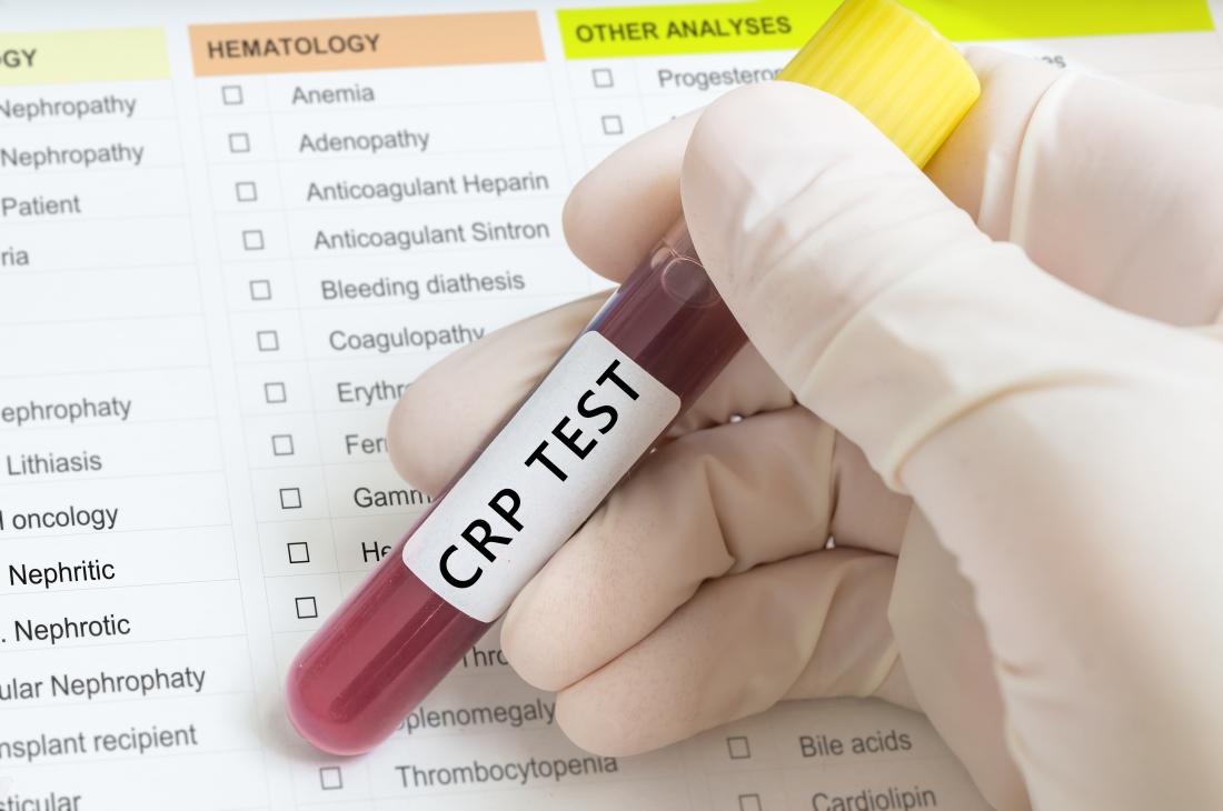 cpr-blood-test-in-vial-sample-in-front-of-document