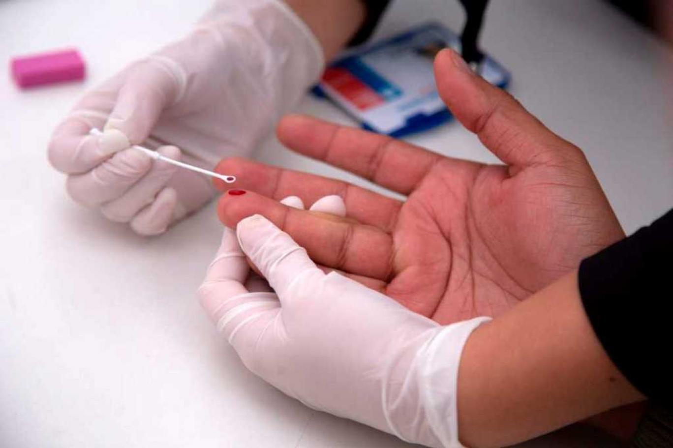 فيروس الايدز وتجارب جديدة للقاح