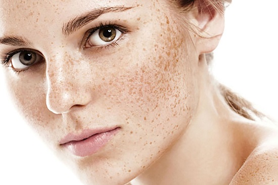 Remove freckles from the face