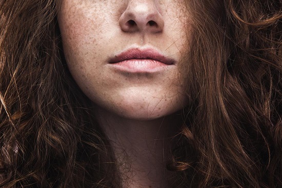 Natural ways to remove freckles