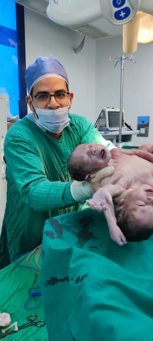 نجاح عملية ولادة توام ملتصق بمستشفي المنصورة الجامعي