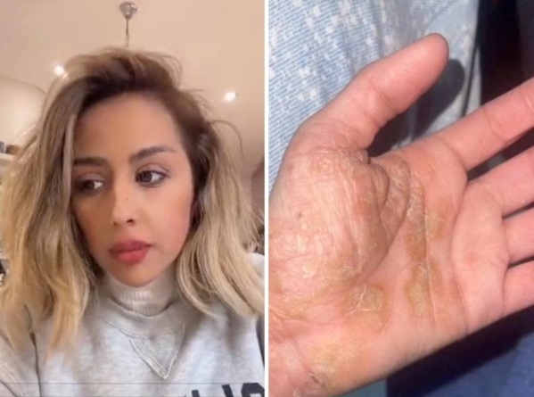 مرض فرح الهادي