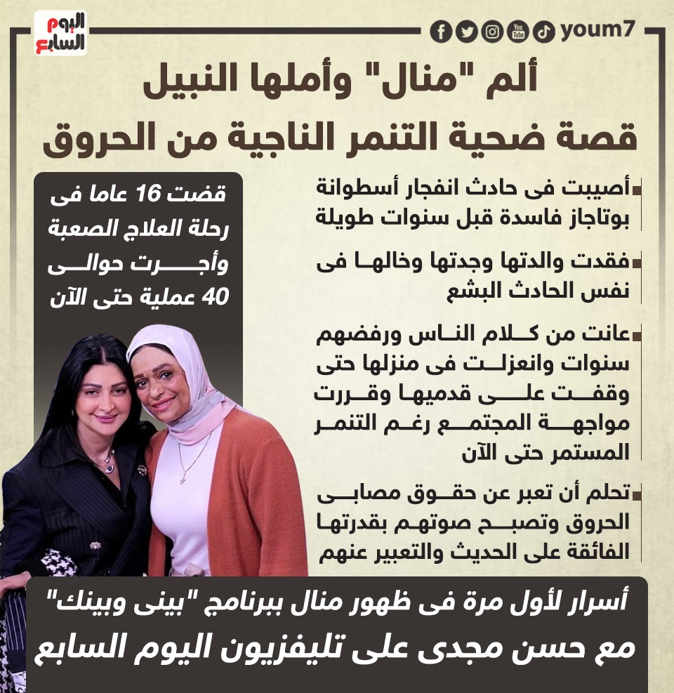 قصة ضحية التنمر الناجية من الحروق قصة ضحية التنمر الناجية من الحروق