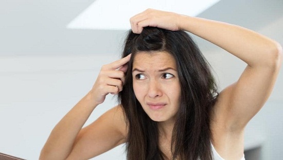 وصفات  للتخلص من قشرة الشعر