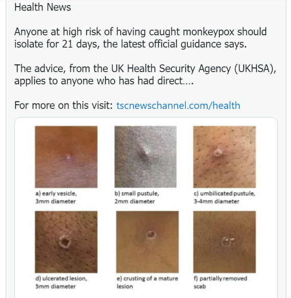 Images showing how monkeypox spreads