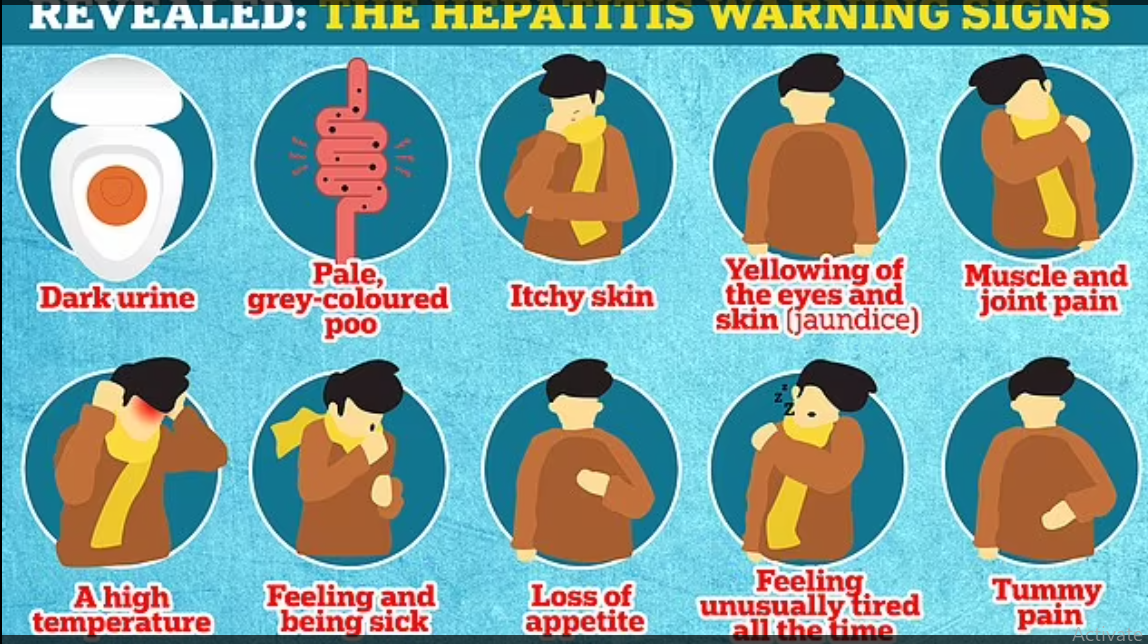 Symptoms of mysterious hepatitis