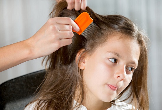 Natural recipes to get rid of lice