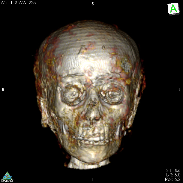 Golden mummy face 3D front copy