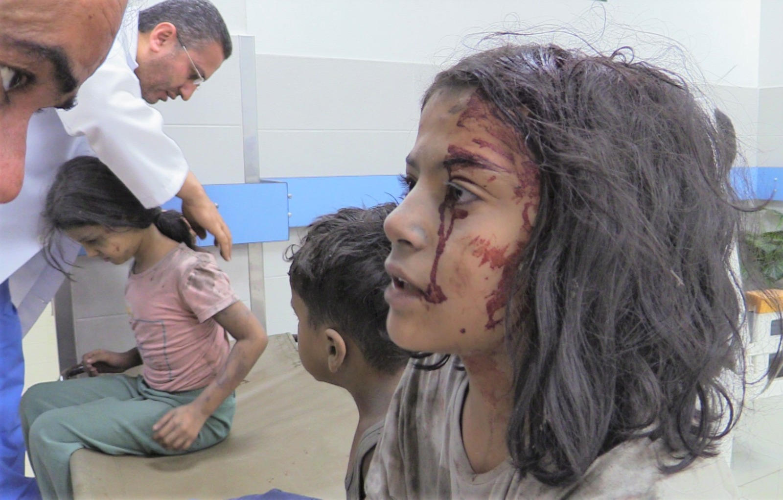 إصابة طفلة فلسطينية في غزة