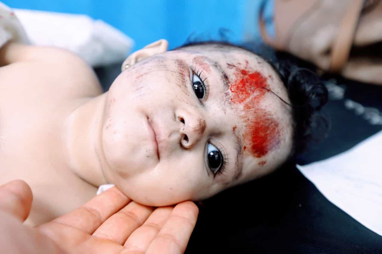  أطفال غزة