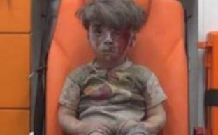 الطفل السورى عمران