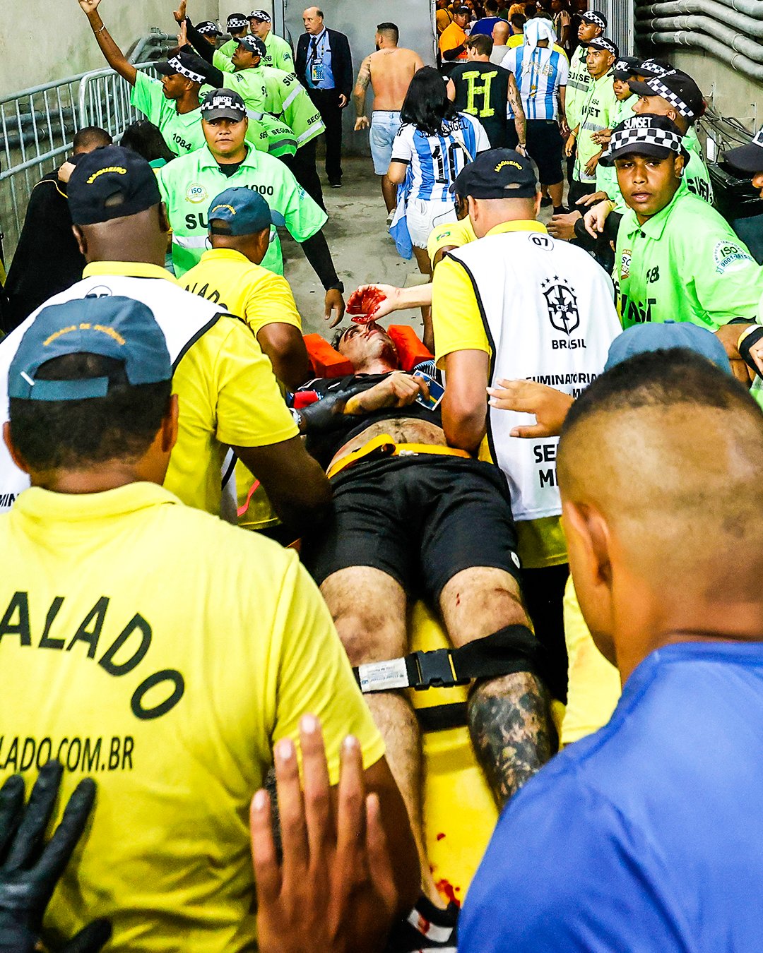 أحد الجماهير بعد الاعتداء عليه في مباراة البرازيل ضد الأرجنتين