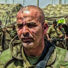 آثار الإصابة على وجه قائد لواء جولاني السابق غسان عليان الذي استهدفته المقاومة في معارك الشجاعية 2014