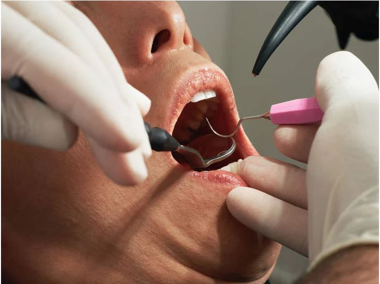 عامل نظافة يحتل صفقة طبيب اسنان