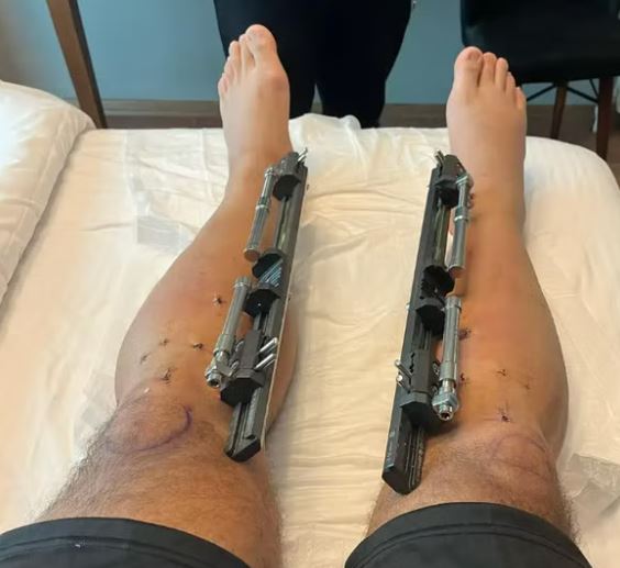 after the operation