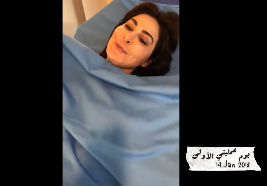 أو عملية لـ اليسا أول عملية لـ اليسا