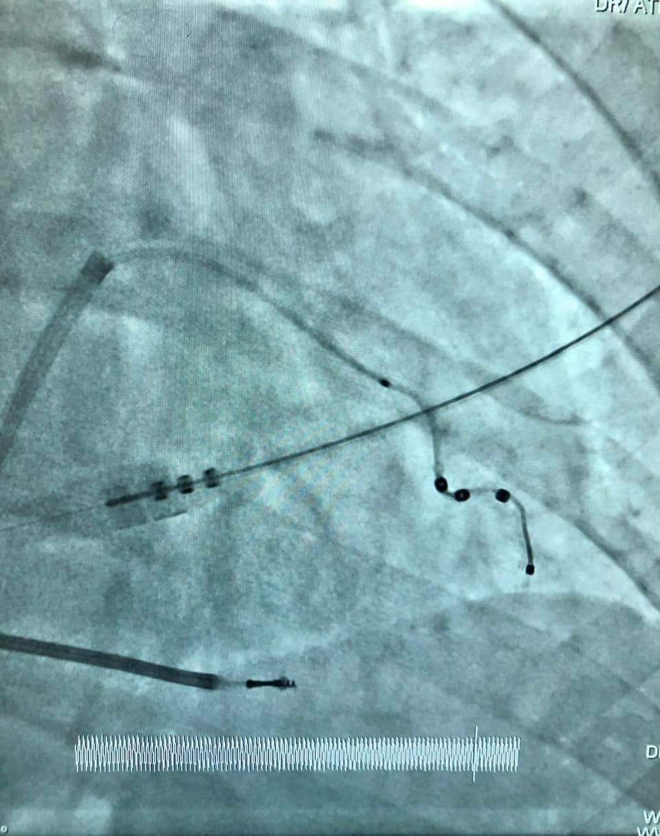جانب من إجراءات العملية جانب من إجراءات العملية