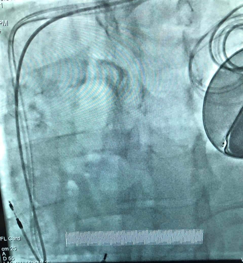 جانب من إجراءات العملية بمستشفى المنصورة التخصصي جانب من إجراءات العملية بمستشفى المنصورة التخصصي