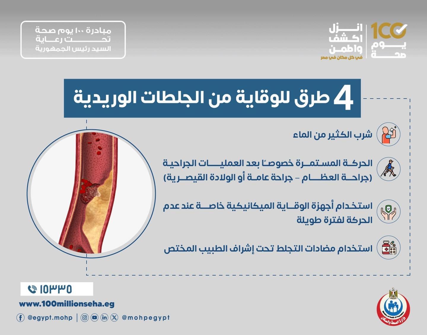 4 طرق للوقاية من الجلطات الوريدية