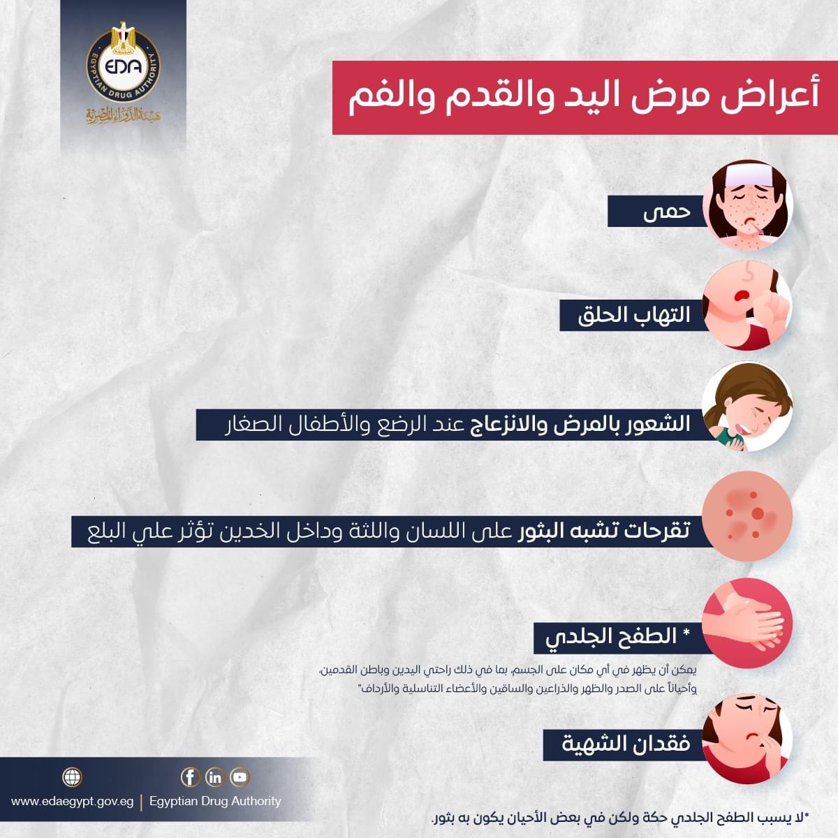 حقائق هامة عن مرض فيروس كوكساكى