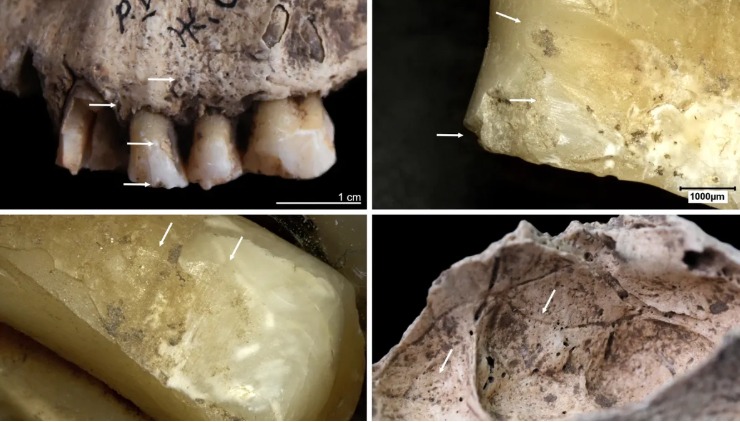 بقايا عظام وأسنان