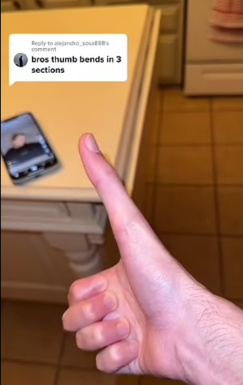 جاكوب يستعرض اصبعه