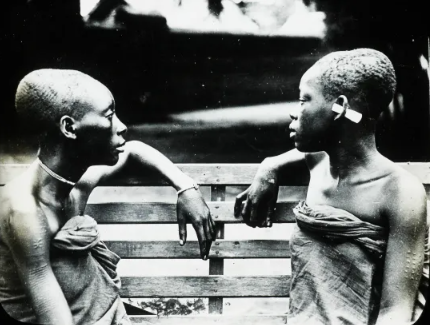 امرأتان من الكونغو بجمجمتين ممدودتين