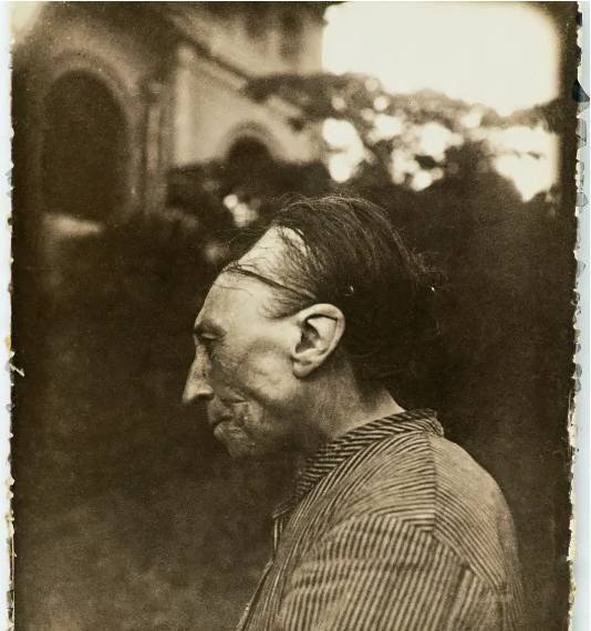 رجل من تولوز بجمجمة ممدودة