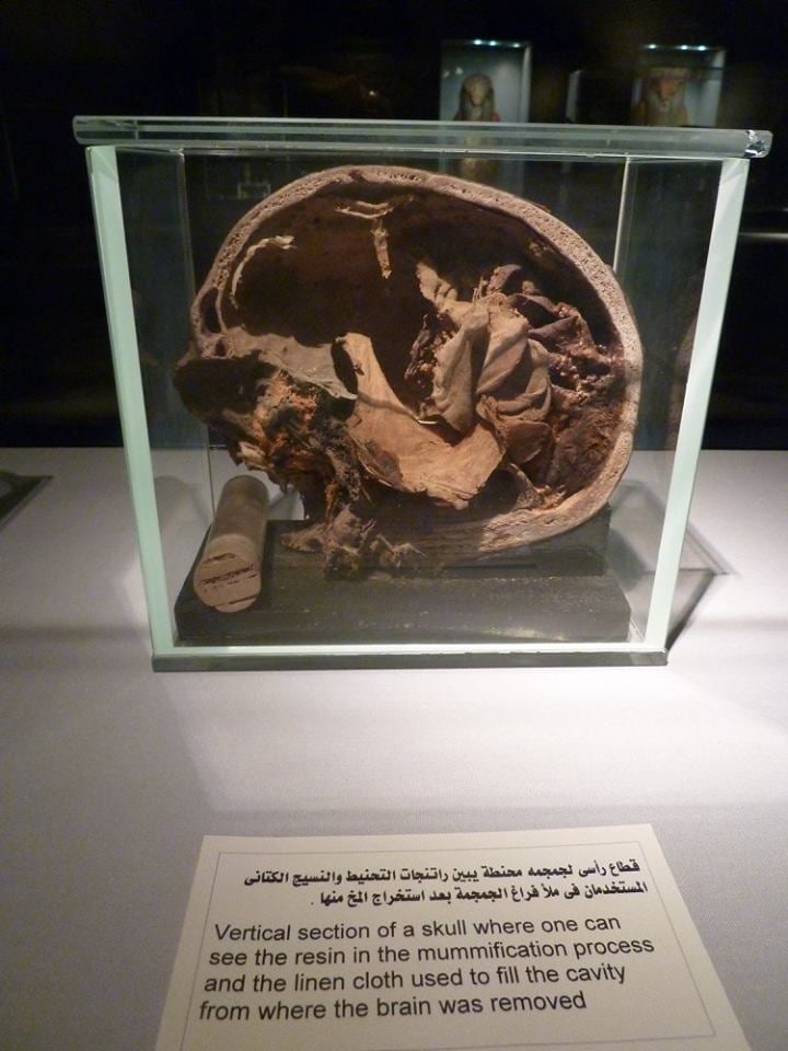 جزء من مخ انسان داخل متحف التحنيط جزء من مخ انسان داخل متحف التحنيط